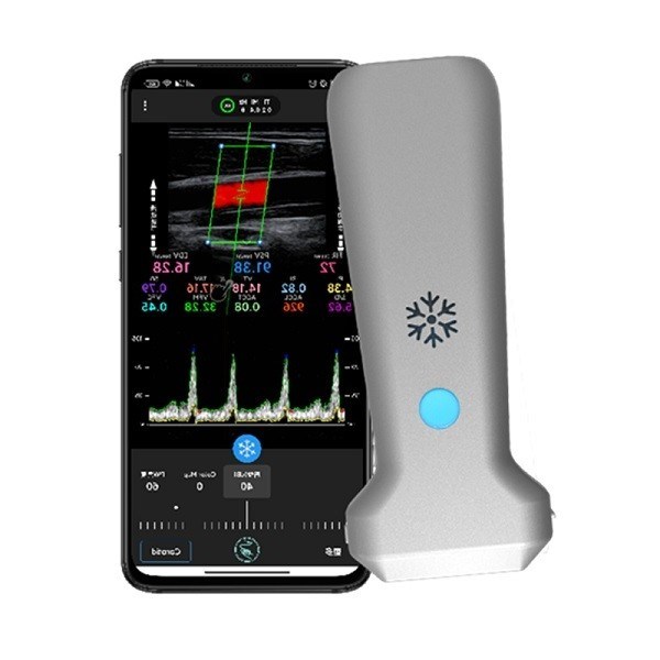 Scanner à ultrasons portatif linéaire sans fil certifié CE | Sonde à ultrasons Doppler couleur portable 8,3 MHz