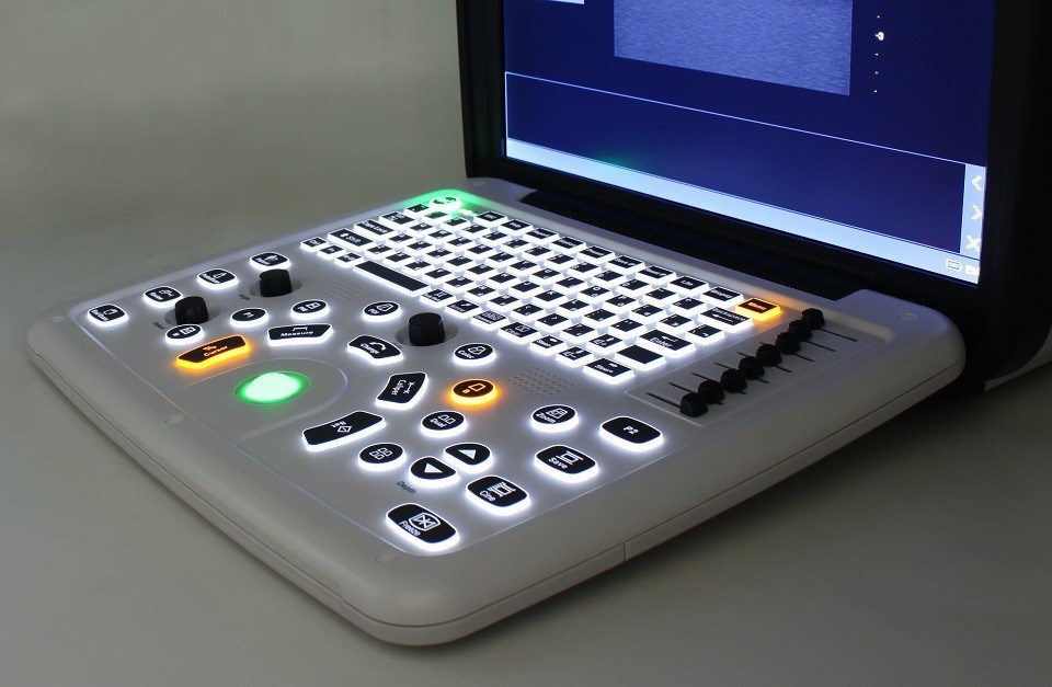 Système d'échographie Doppler couleur portable DCU10 avec écran HD de 15 pouces pour l'imagerie obstétricale/gynécologique, abdominale et cardiaque