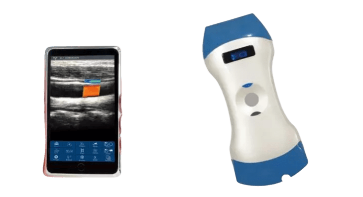 Sonde à ultrasons portable sans fil à double tête à 128 éléments — Une sonde pour l'imagerie profonde, l'imagerie superficielle et le diagnostic sur le lieu de soins