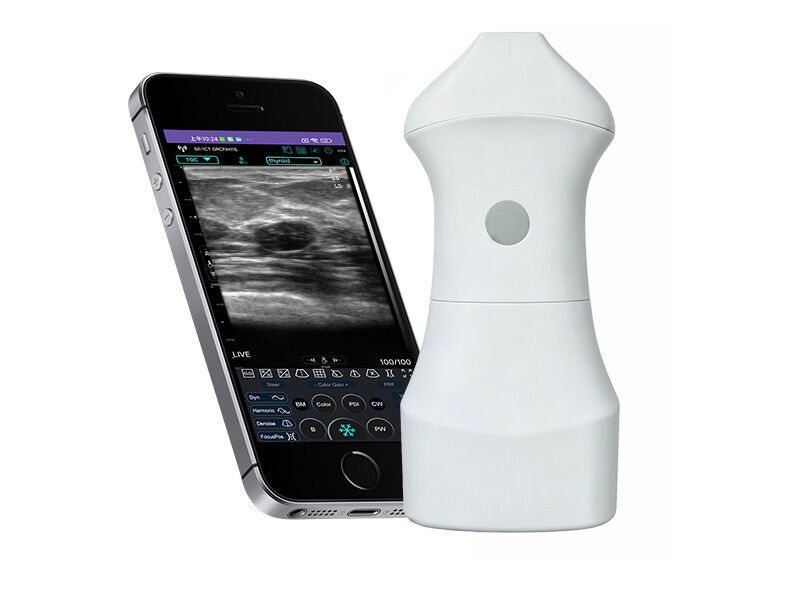 Sonde à ultrasons cutanée haute fréquence 24 MHz pour la médecine esthétique, la dermatologie et les procédures injectables